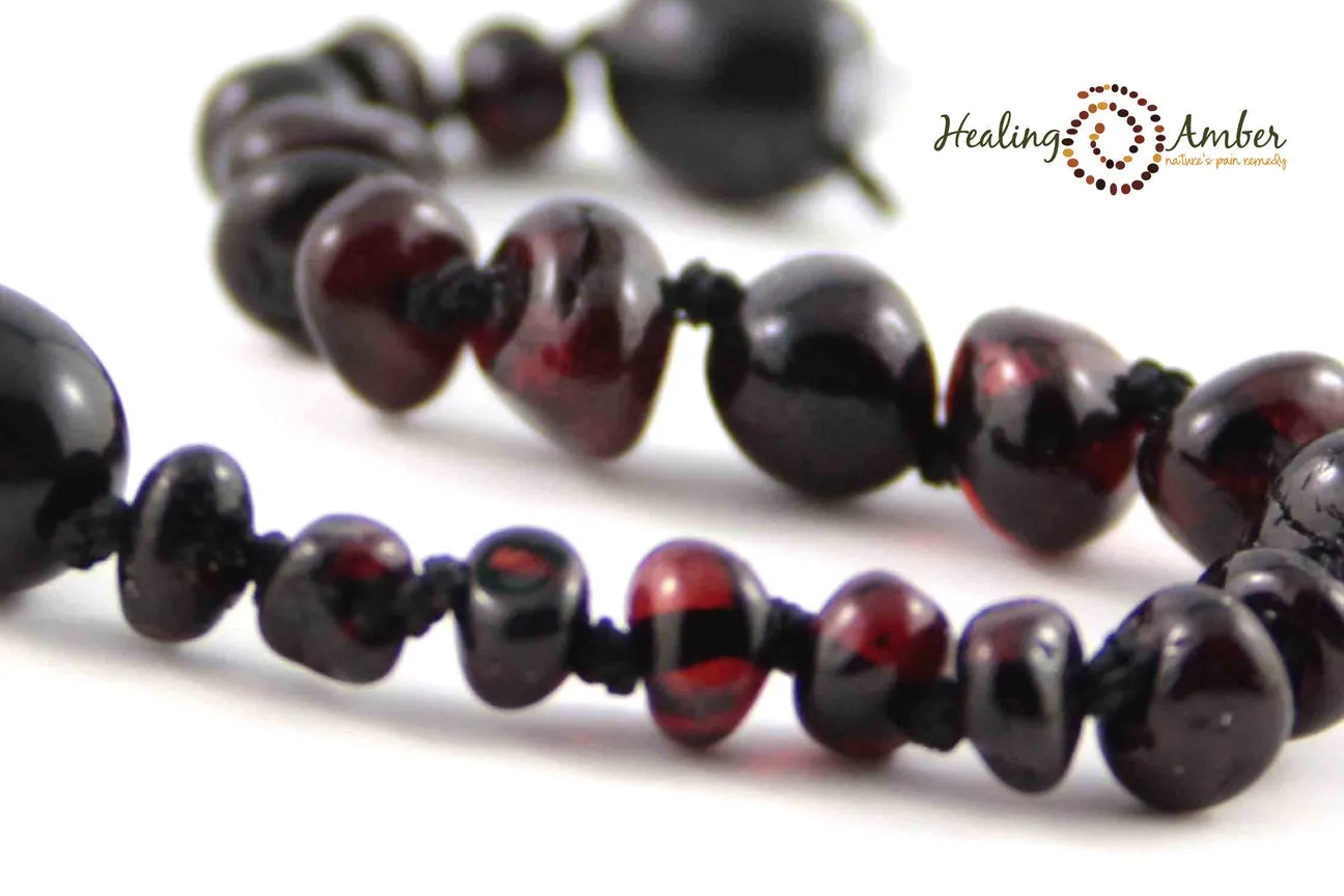 Healing Amber Polished Necklace - 11"