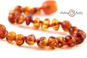 Healing Amber Polished Necklace - 11"
